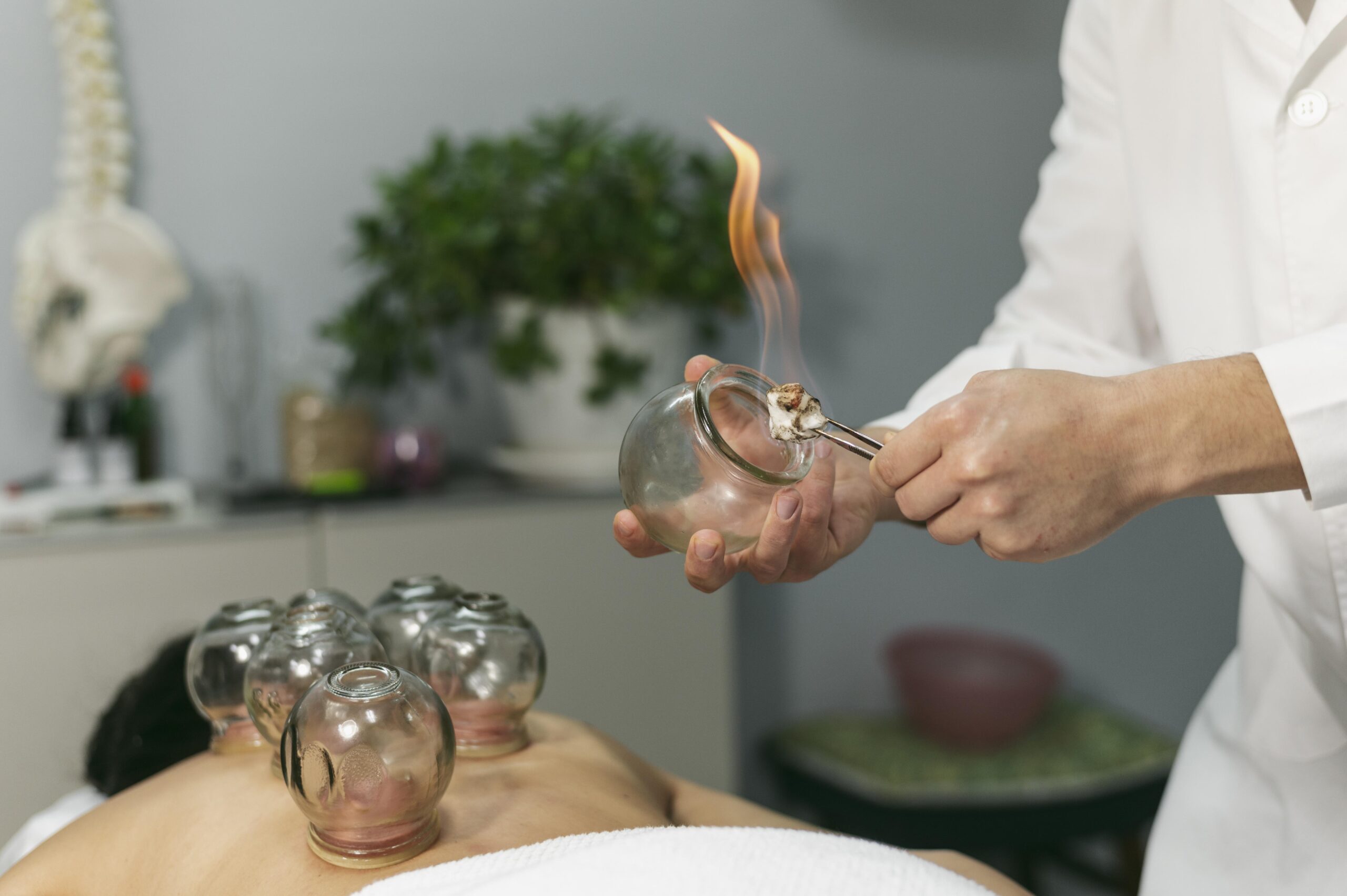 Cupping & Hijama Therapy (হিজামা এবং কাপিং থেরাপি)