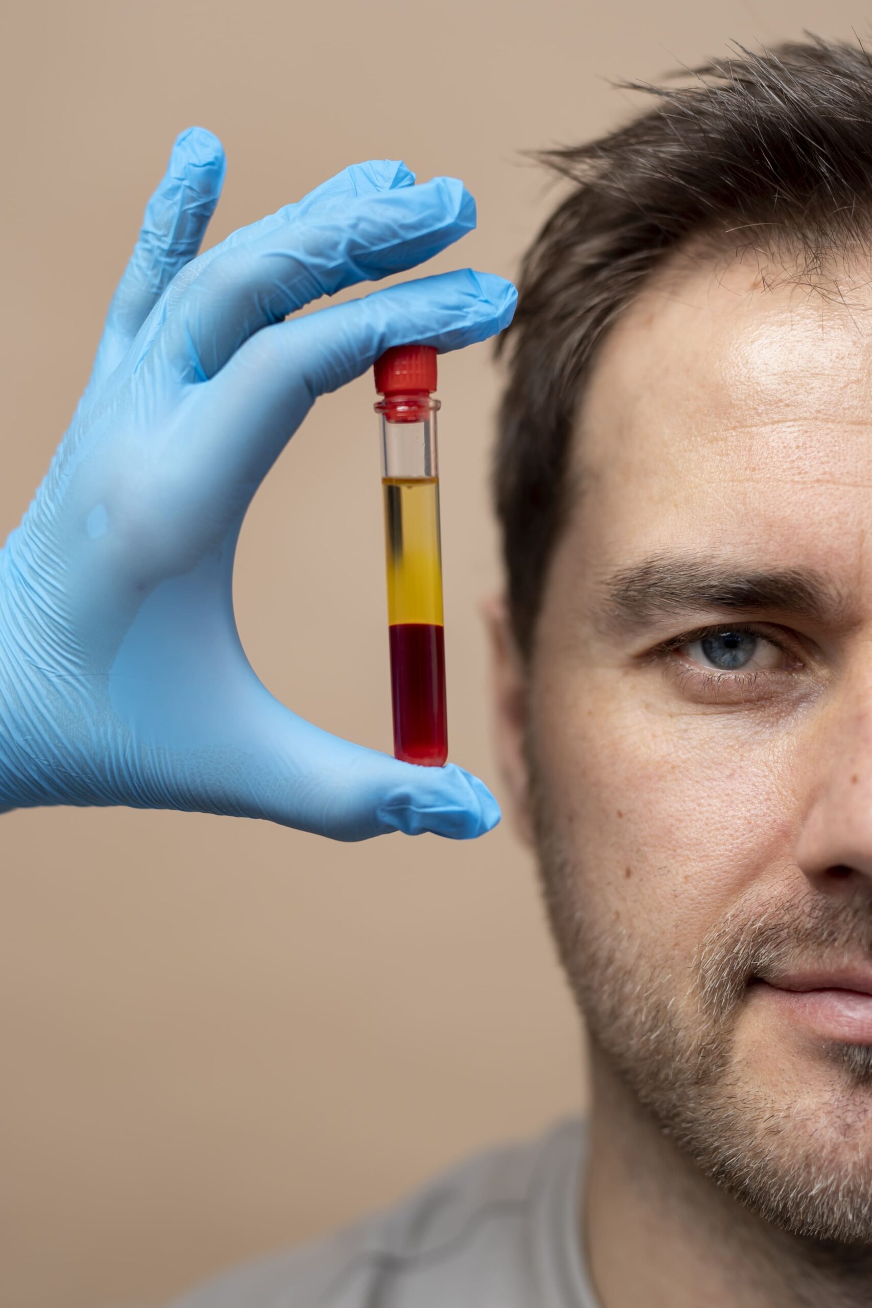 PRP (Platelet-Rich Plasma) Therapy
