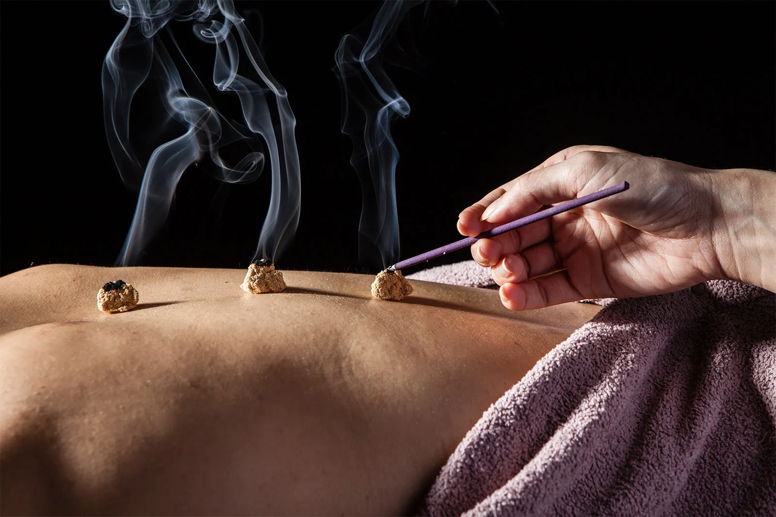 Moxibustion Therapy